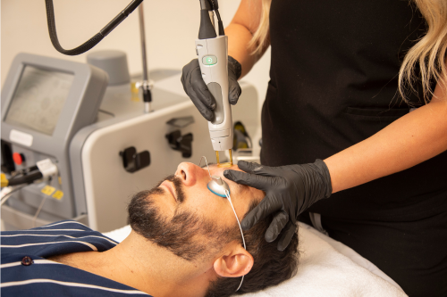 Men's Laser Hair Removal Athens, GA